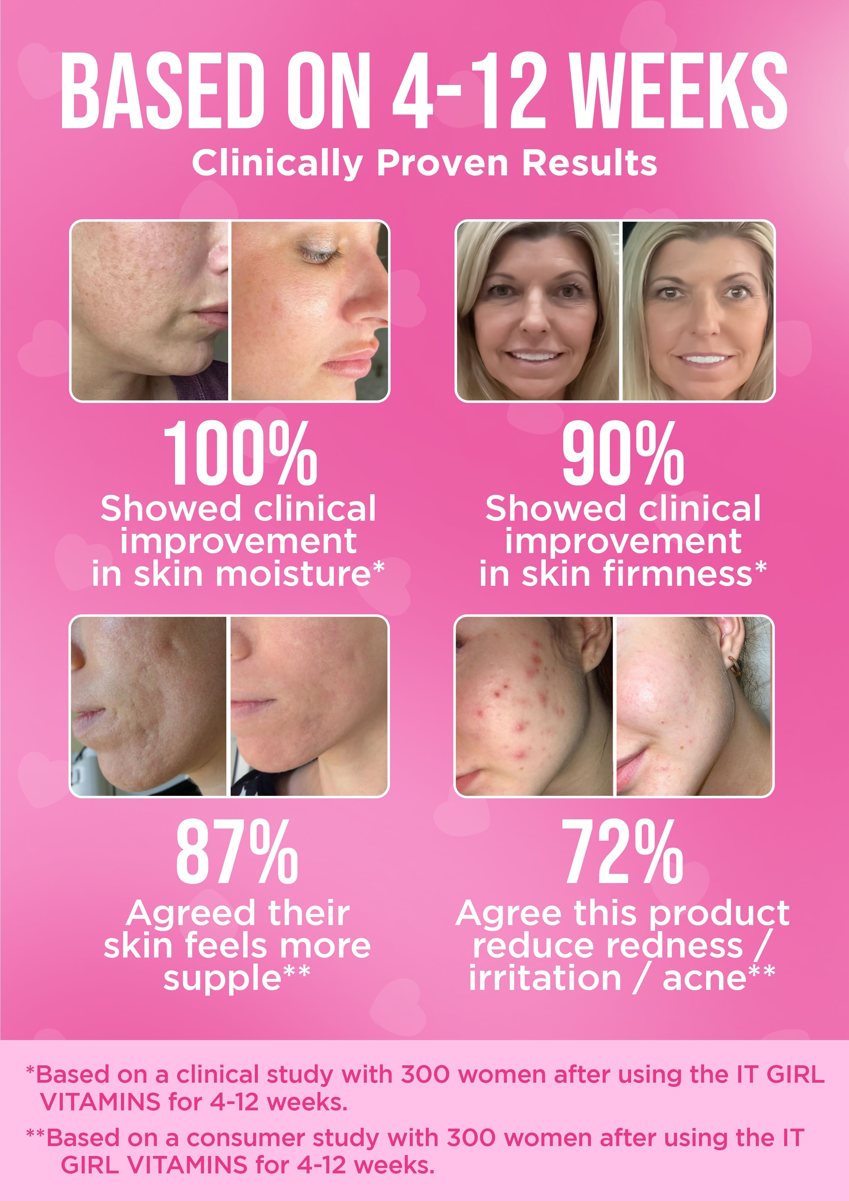 It Girl Skin – Skin Food by It Girl Vitamins