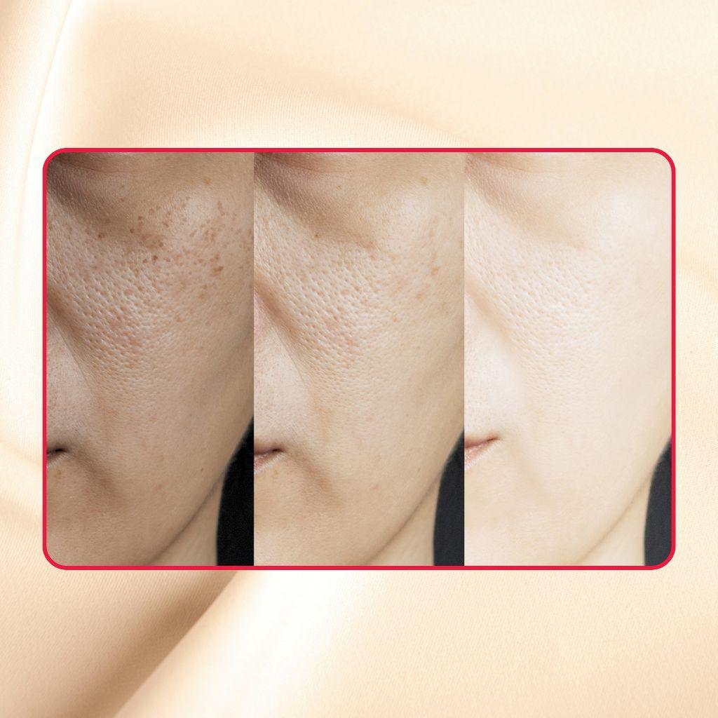 Thick As Thieves Pure Glycolic Acid Lactic Acid Extreme Gel Peel - 50ml by gymsegbë