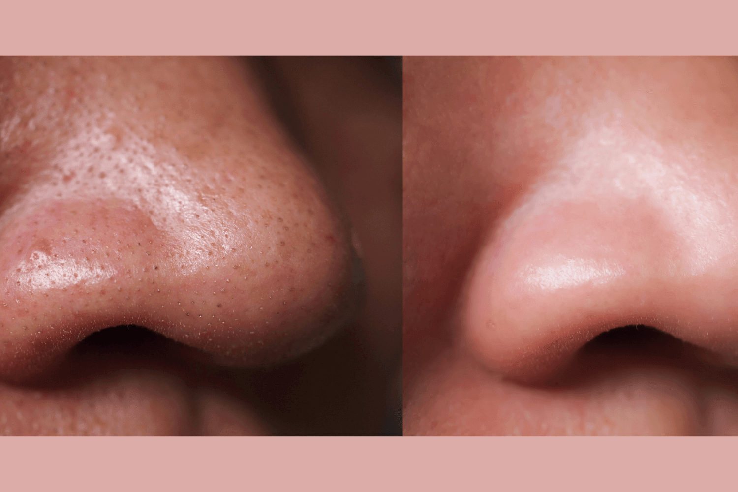 Ultra-Advanced Anti-Aging Daily Resurfacing Pads by gymsegbë