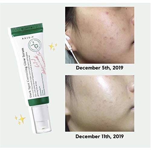 AXIS-Y Dark Spot Correcting Glow Serum by AsiaBeautyMall