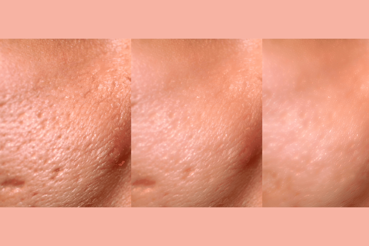 Ultra-Advanced Anti-Aging Daily Resurfacing Pads by gymsegbë