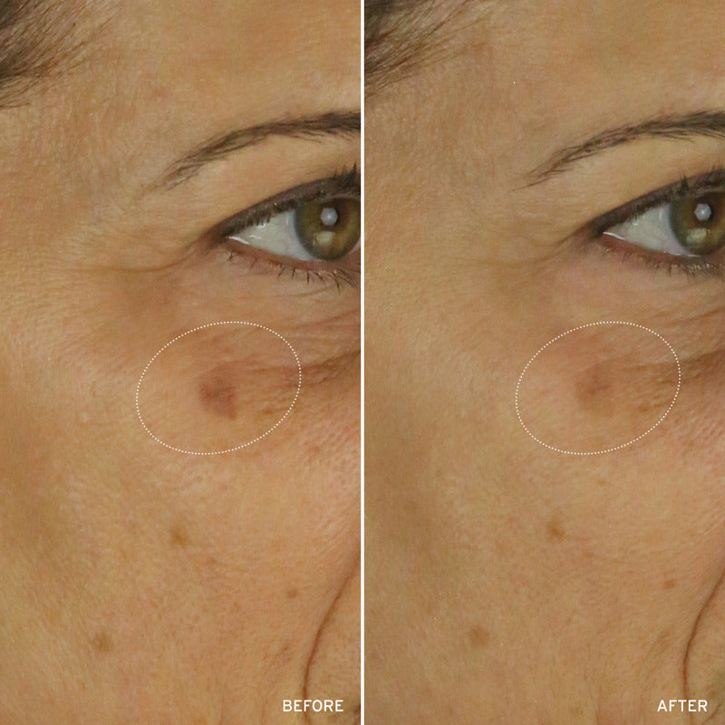 NAD+ CELL ENERGIZING TREATMENT by Korean Skin Care