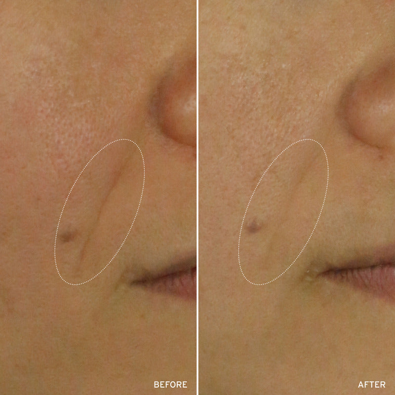 NAD+ CELL ENERGIZING TREATMENT by Korean Skin Care