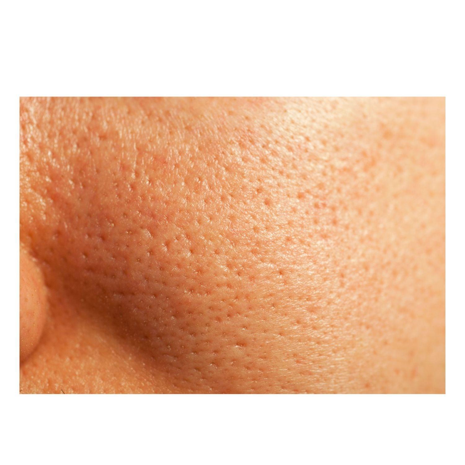 Thick As Thieves Pure Glycolic Acid Lactic Acid Extreme Gel Peel - 50ml by gymsegbë