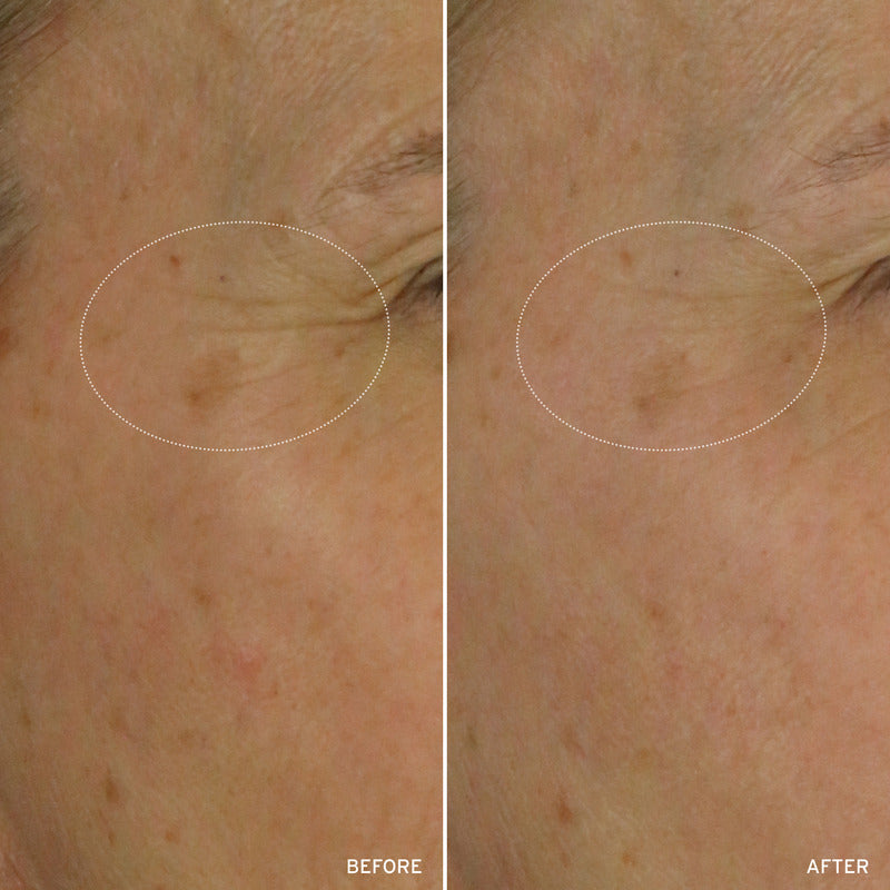 NAD+ CELL ENERGIZING TREATMENT by Korean Skin Care