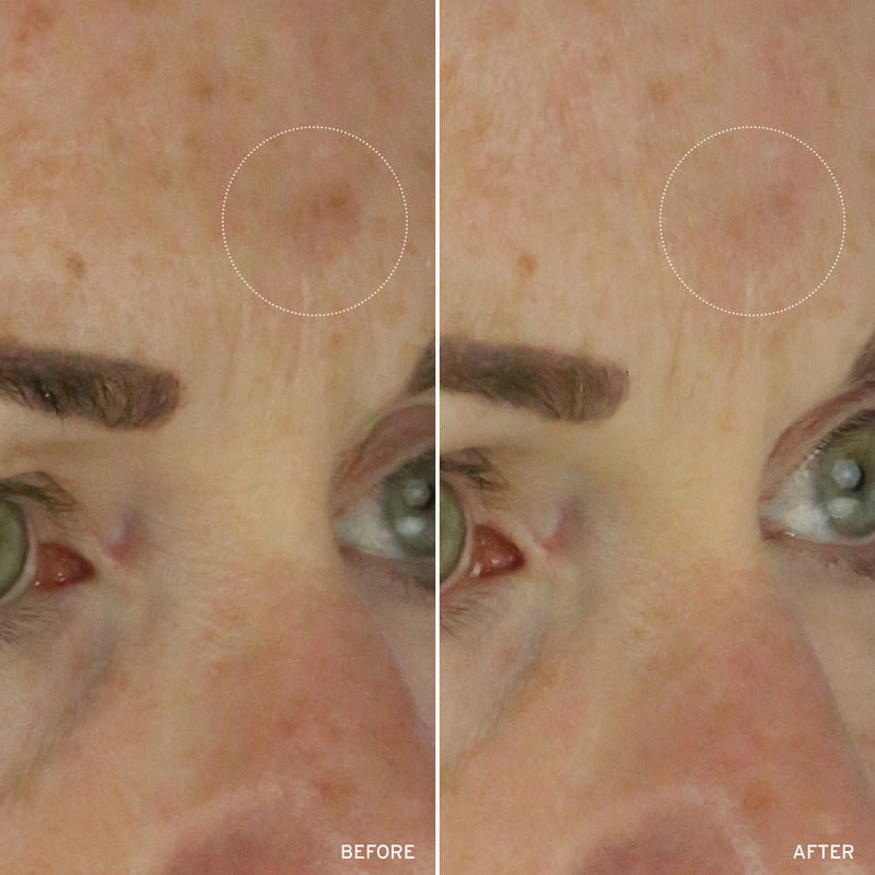 NAD+ CELL ENERGIZING TREATMENT by Korean Skin Care