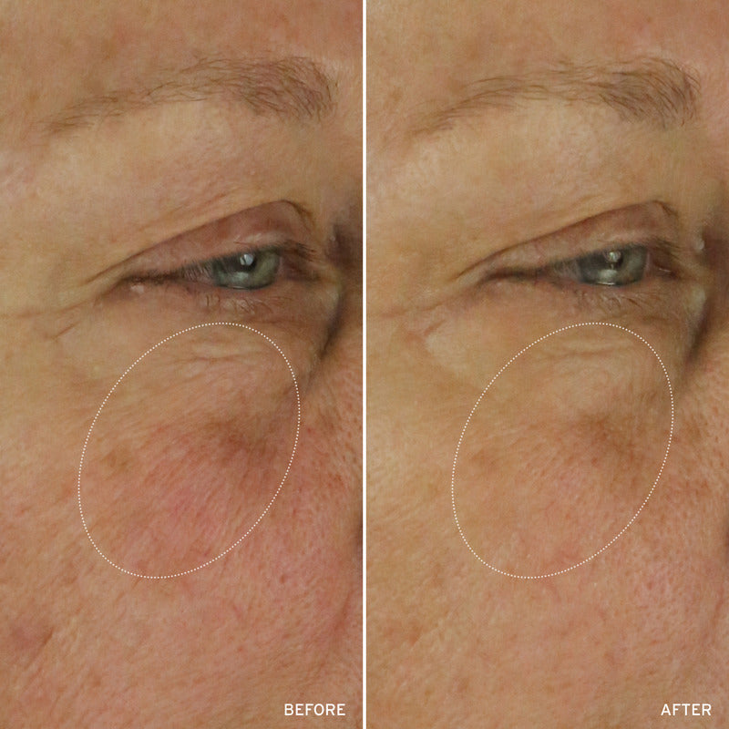 NAD+ CELL ENERGIZING TREATMENT by Korean Skin Care