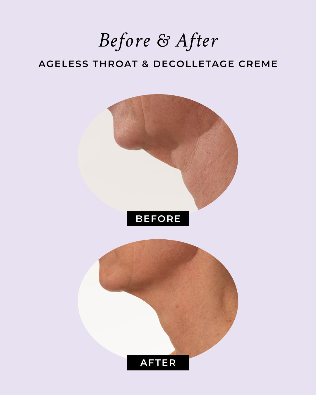 Ageless Throat & Decolletage Anti-Aging Neck Creme by PRAI Beauty