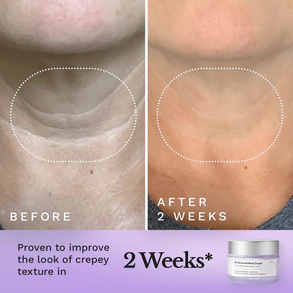 NF Advanced Neck Cream by Clearly Basics