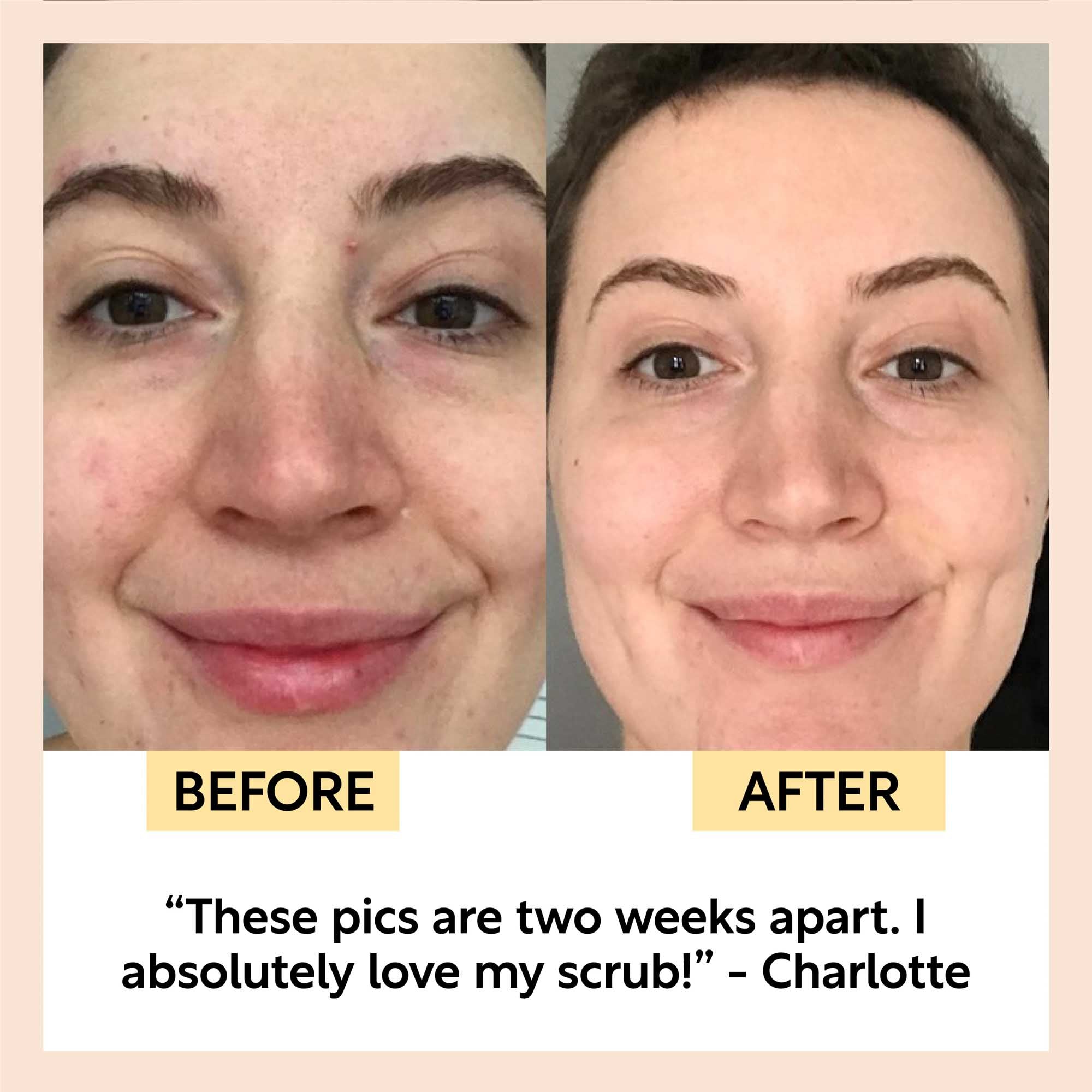 Travel-Size Skincare Bundle by UpCircle
