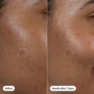 Hero Cosmetics Dark Spot Correct 10ml - New by This is Beauty US