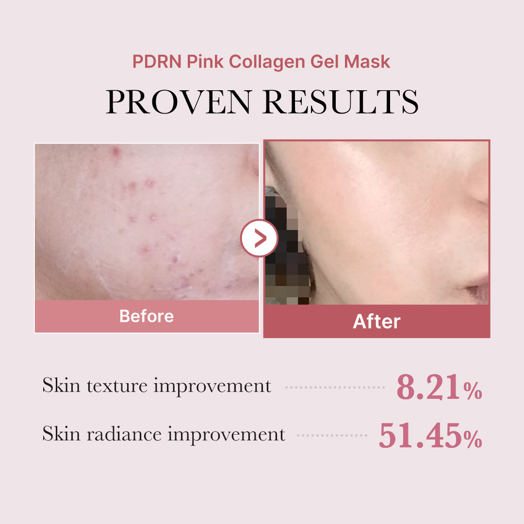 Salmon PDRN Pink Collagen Jelly Gel Mask by Korean Skin Care