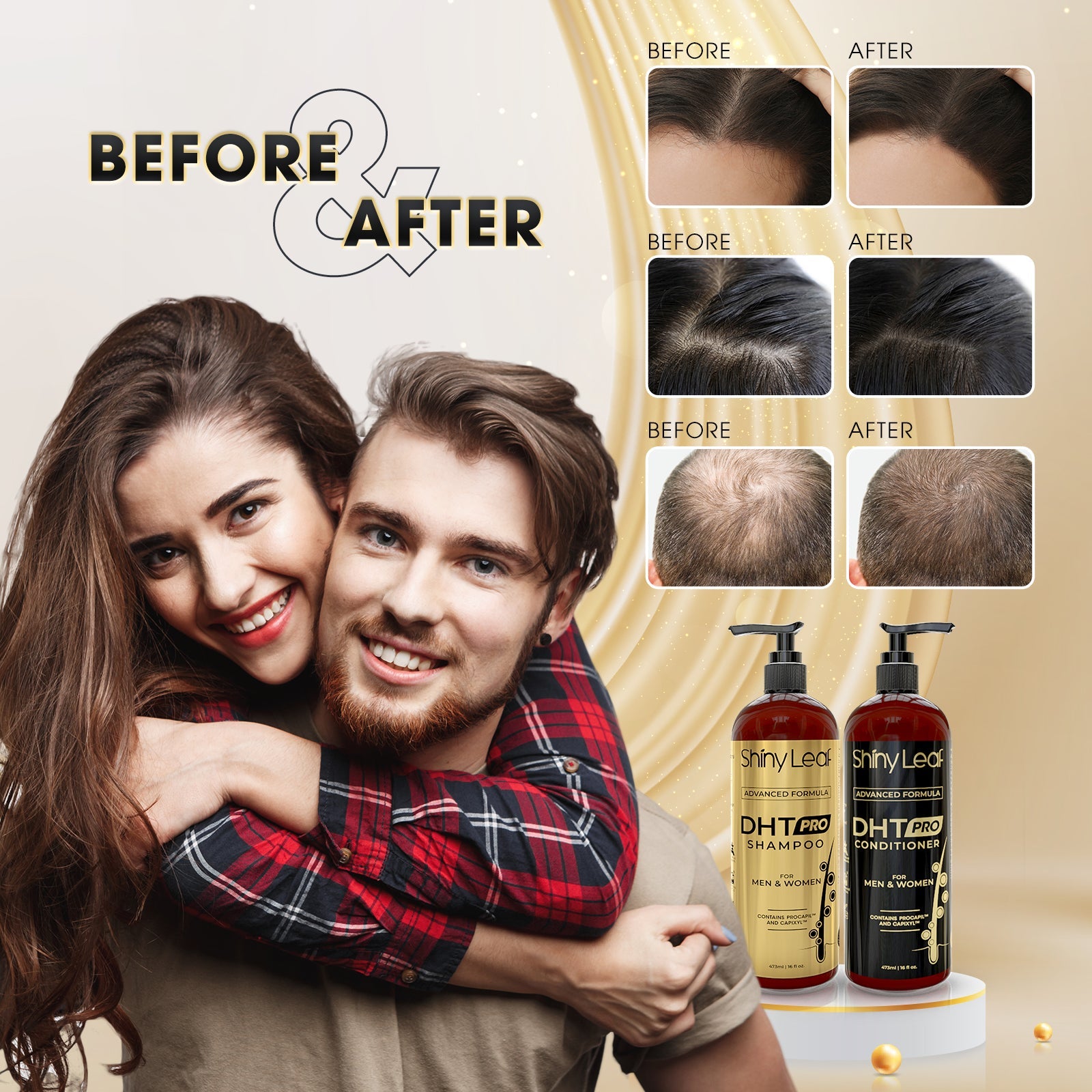 Bariatric Multivitamin with Iron With DHT Pro Shampoo and Conditioner Hair Care Bundle by Shiny Leaf