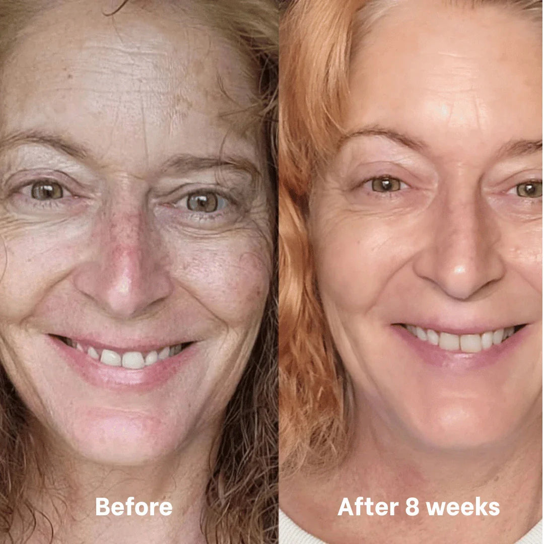 Collagen & Niacinamide wrapping mask by Skynflow