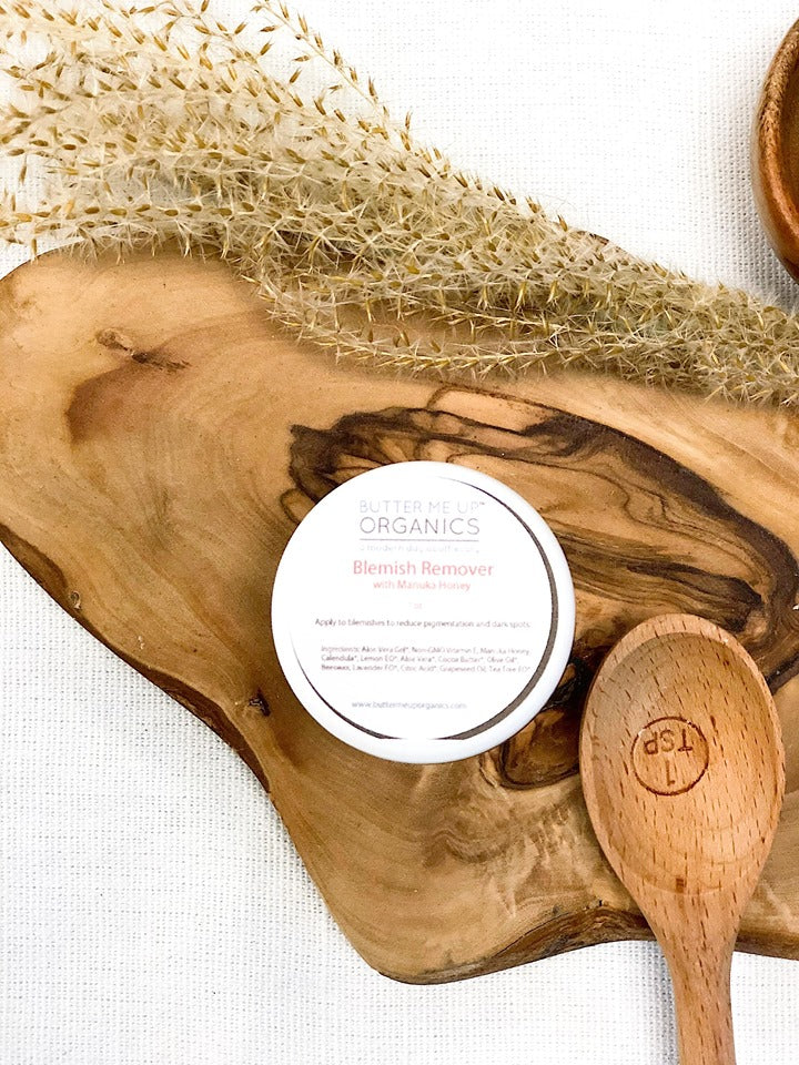 Organic Blemish Cream/ Dark Spot Remover / Scar Cream / Acne Spot Treatment by Butter Me Up Organics