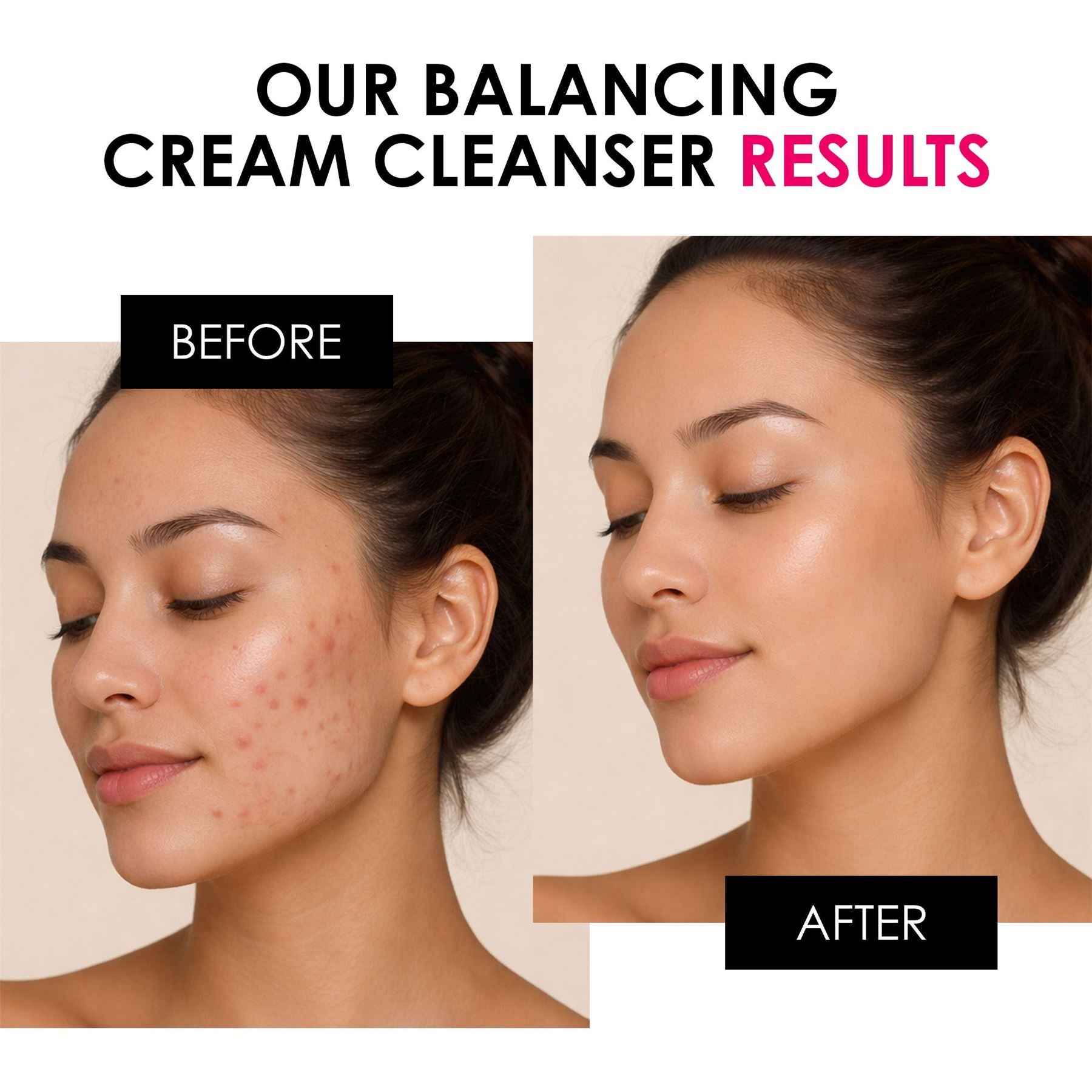 Balancing Vitamin C & Glycolic Acid Cream Cleanser 200ml by skinChemists US