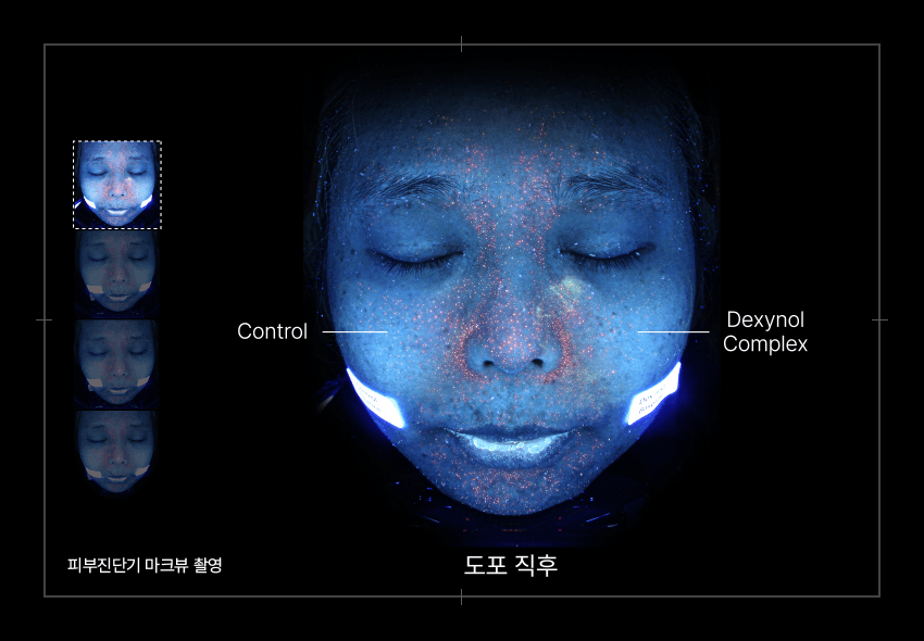 PERCENT SCIENCE Dexynol-16.3 Set. - Acne/Trouble by KBX