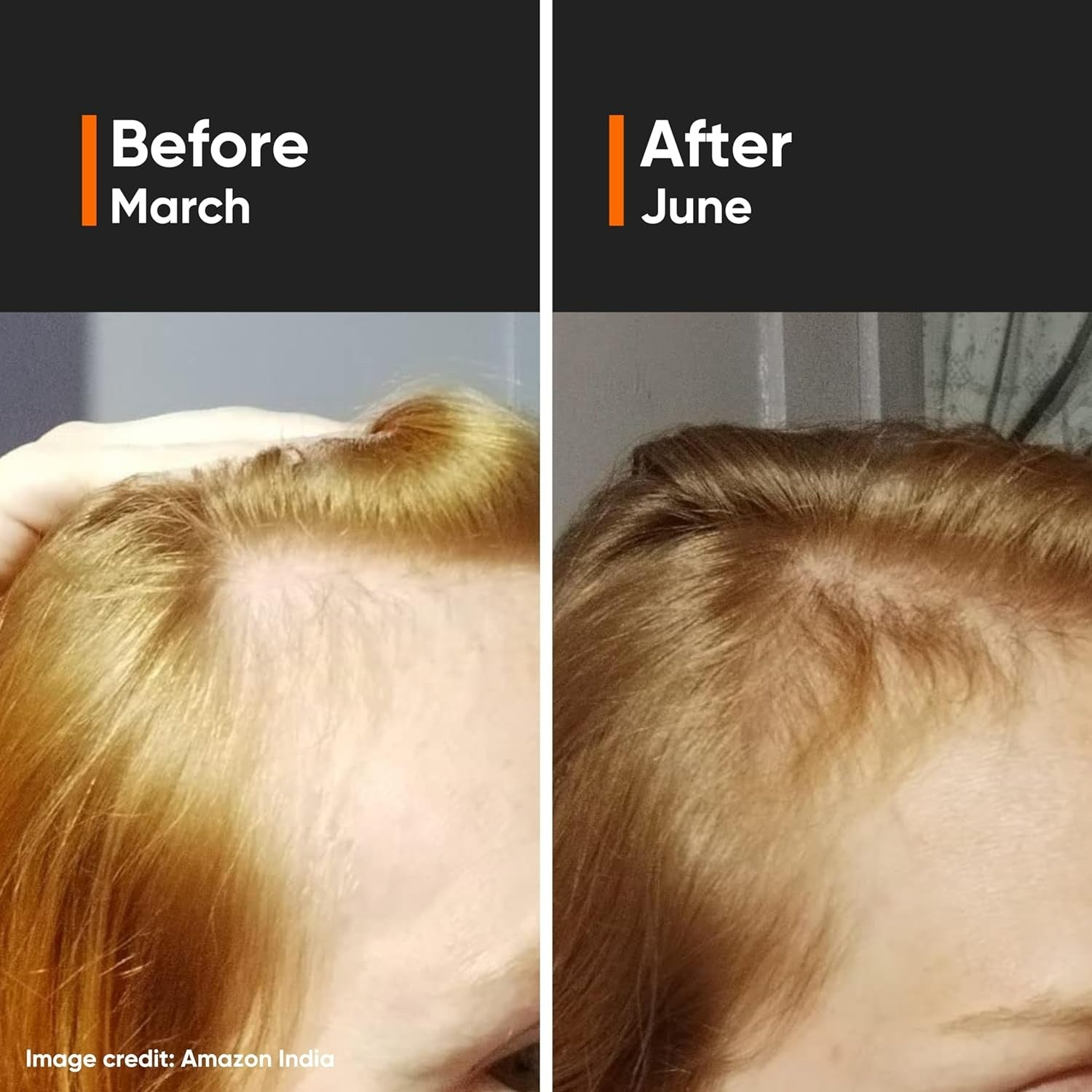 Minimalist Hair Growth Actives 18% Hair Serum by Dista