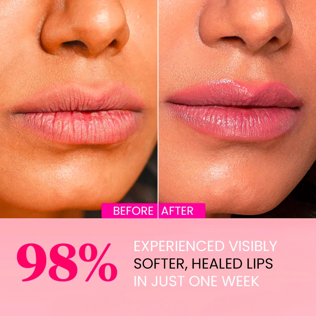 Plumping Lip Masks - Collagen, Hyaluronic Acid, Centella Asiatica by Skynflow