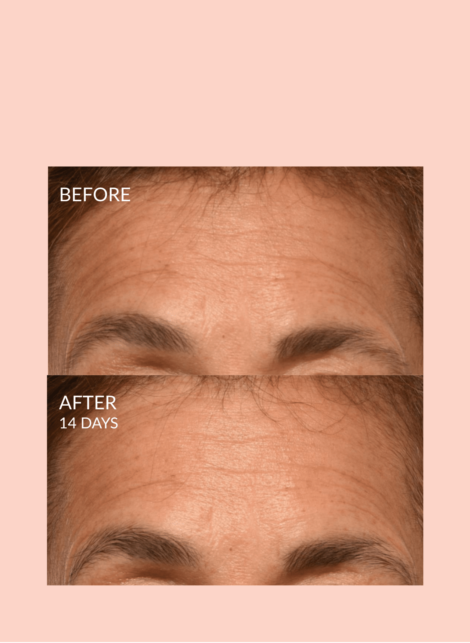Triple Lift Molecule Mask by Caire Beauty