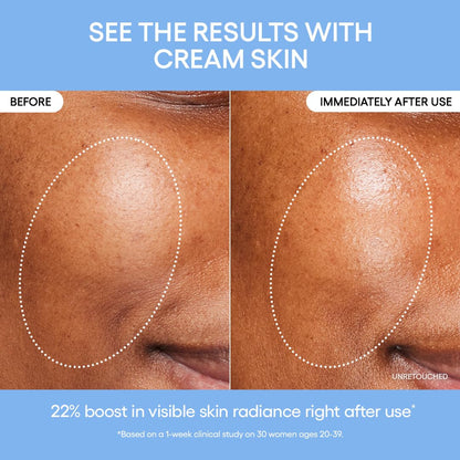 Water Bank Blue Hyaluronic Moisturizer: Barrier-Boosting Hydration, Squalane, Ceramide, Dermatologist-Tested by Korean Skin Care