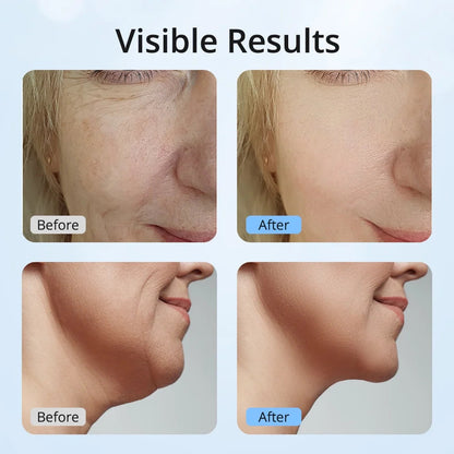 7 Color LED Neck Tightening Facial Device,Red Light Therapy for Face by Korean Skin Care