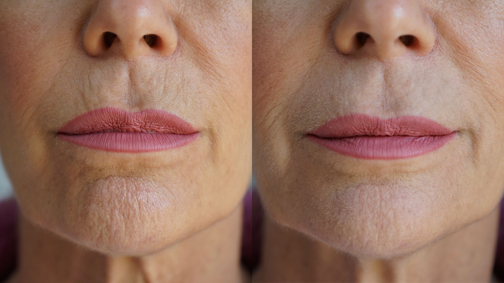 Ageless Lip &amp; Line Filler by PRAI Beauty