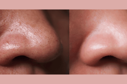 Ultra-Advanced Anti-Aging Daily Resurfacing Pads by gymsegbë