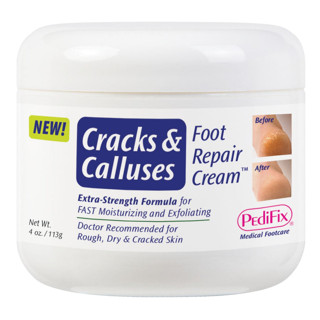 Pedifix Foot Moisturizer Cracks &amp; Calluses 4 Oz. Jar Scented Cream MK by Pasteur Pharmacy