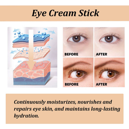 Snail Eye Cream Stick Collagen Fade Fine Lines Wrinkle Lightening Dark Circles Firming Eye Bags Puffiness Moisturizing Eye Cream by Korean Skin Care