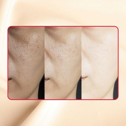 Thick As Thieves Pure Glycolic Acid Lactic Acid Extreme Gel Peel - 30ml by gymsegbë