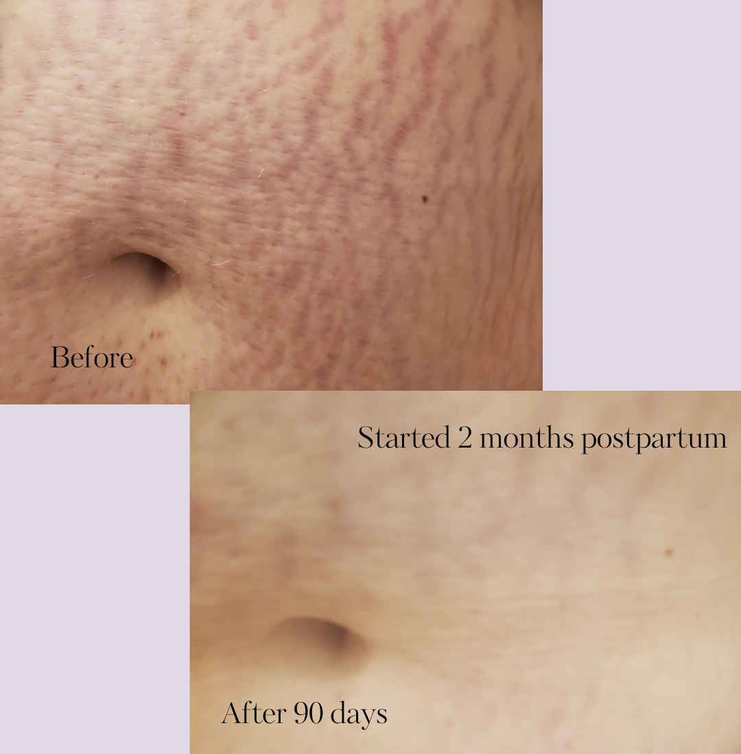 Revitalize Postpartum Cream 4oz by Lavender Meadows Co