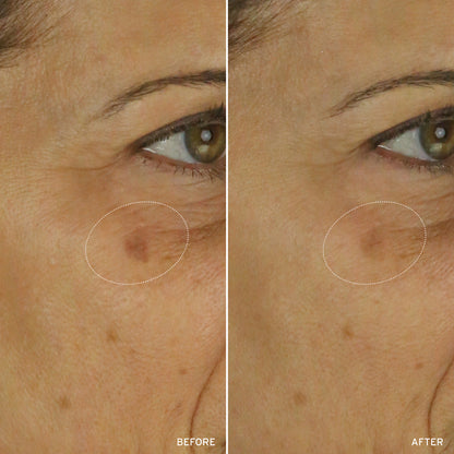 NAD+ CELL ENERGIZING TREATMENT by Korean Skin Care
