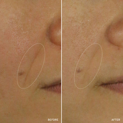 NAD+ CELL ENERGIZING TREATMENT by Korean Skin Care
