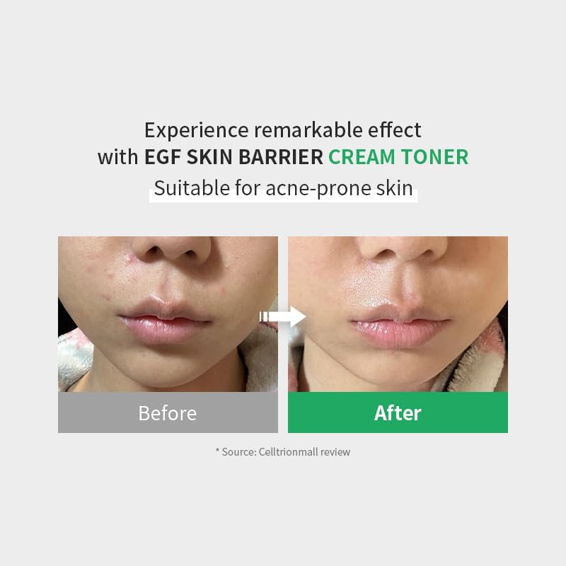 Z+PIDERM ECF Skin Barrier Cream Toner by AsiaBeautyMall