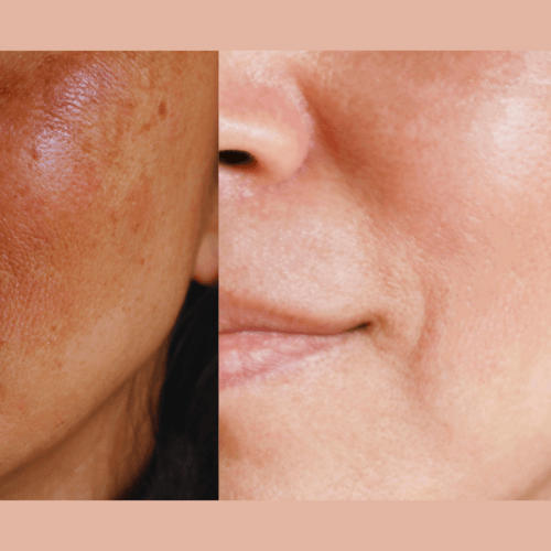 Ultra-Advanced Anti-Aging Daily Resurfacing Pads by gymsegbë