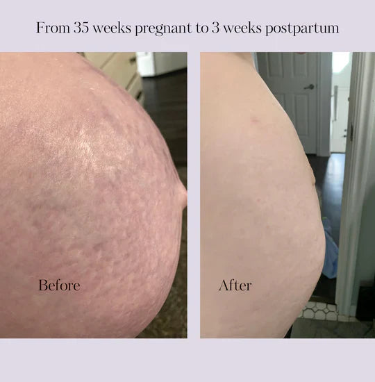 Revitalize Postpartum Cream Refill Pouch by Lavender Meadows Co