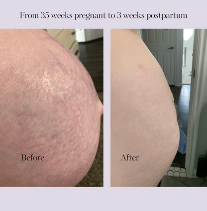 Revitalize Postpartum Cream 4oz by Lavender Meadows Co