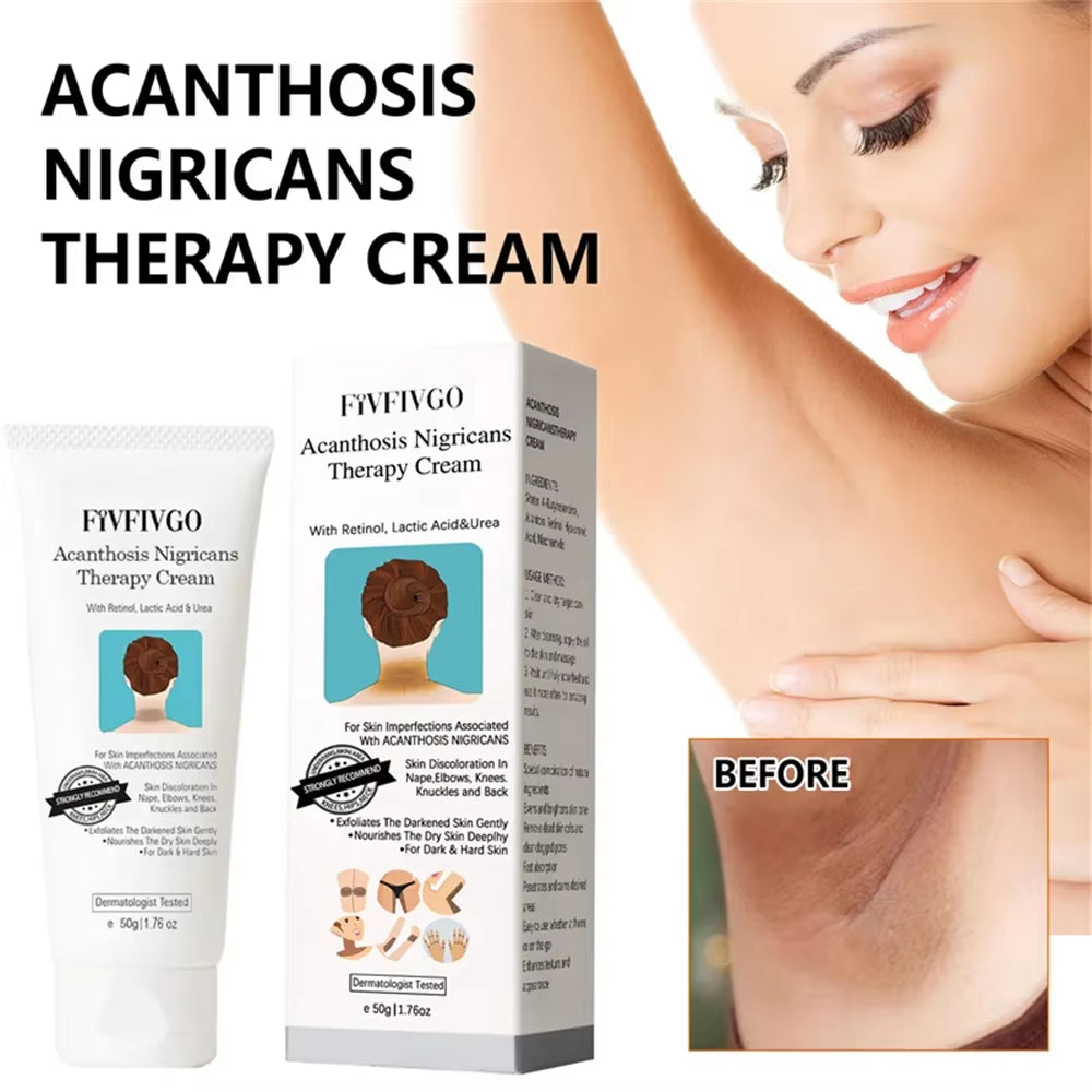 Underarm Creams for Dark Skin Body Crotch Armpit Moisturizing Korean Skincare Products 50G by Korean Skin Care
