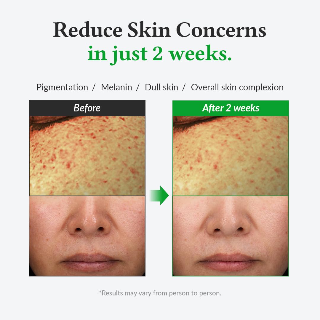Dr. Althea Gentle Vitamin C Serum by AsiaBeautyMall