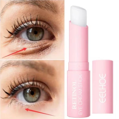 Retinol Eye Cream Instant Remove Eye Wrinkles Eye Dark Circles Bags Remover Moisturising Stick Beauty Health Korean Cosmetics by Korean Skin Care