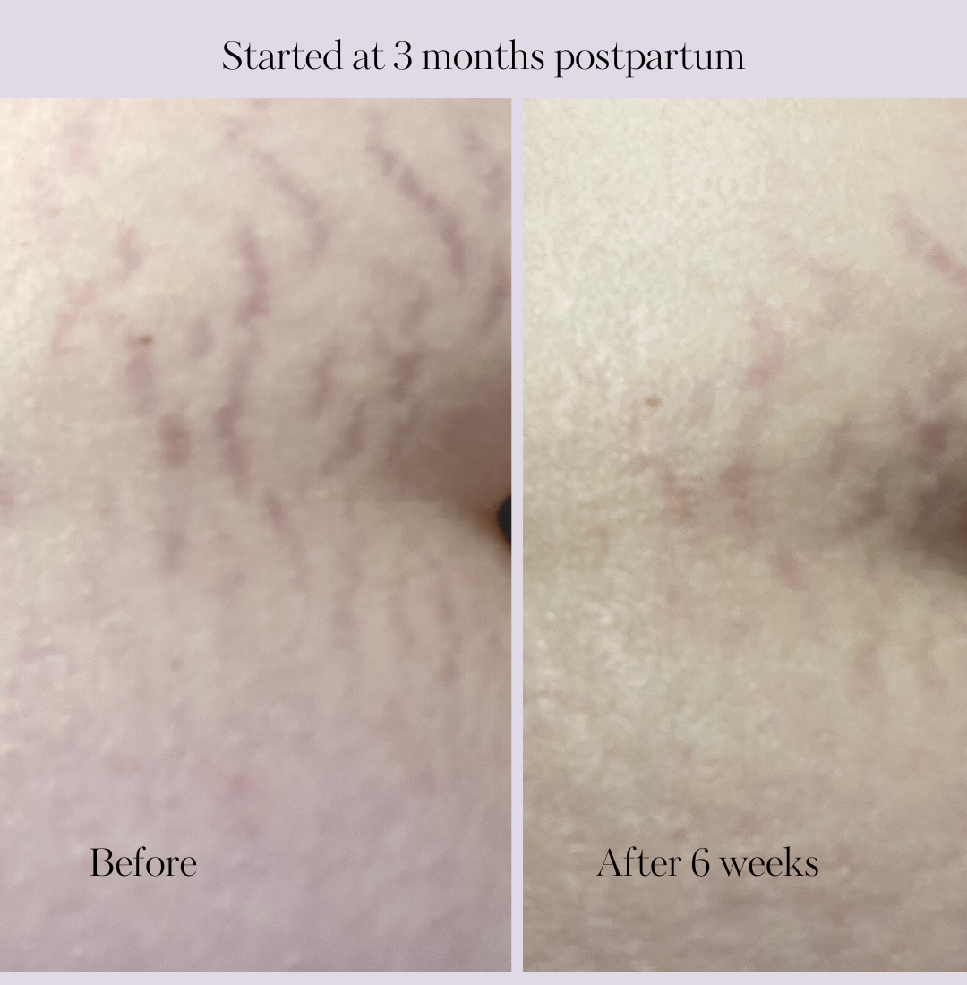 Revitalize Postpartum Cream 4oz by Lavender Meadows Co