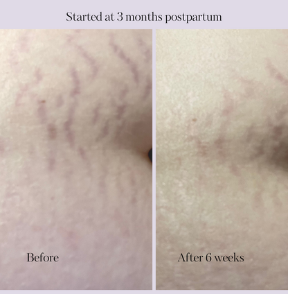 Revitalize Postpartum Cream 4oz by Lavender Meadows Co