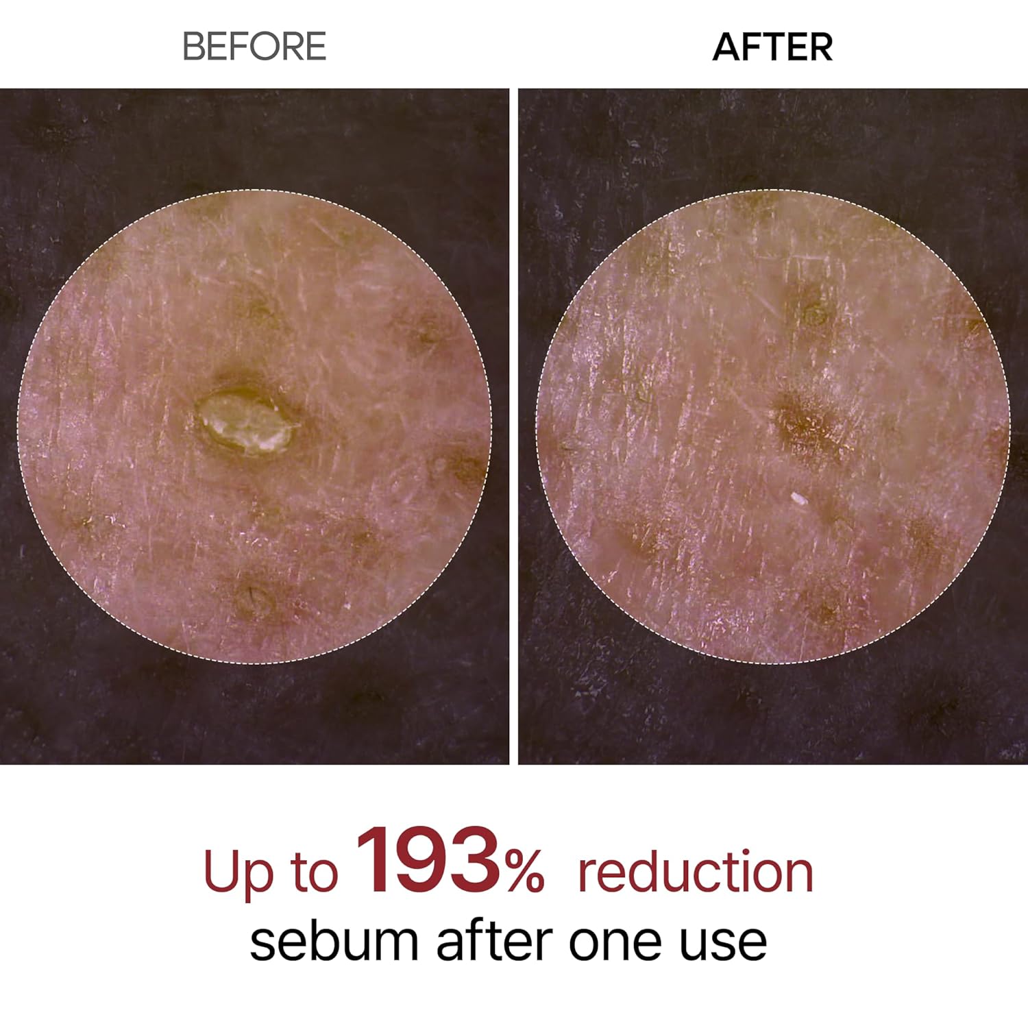 Dr. Melaxin Peel Shot Exfoliant Black Rice Ampoule by AsiaBeautyMall