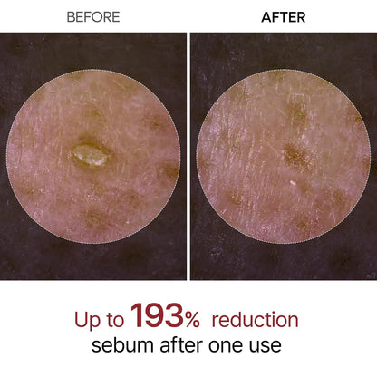 Dr. Melaxin Peel Shot Exfoliant Black Rice Ampoule by AsiaBeautyMall