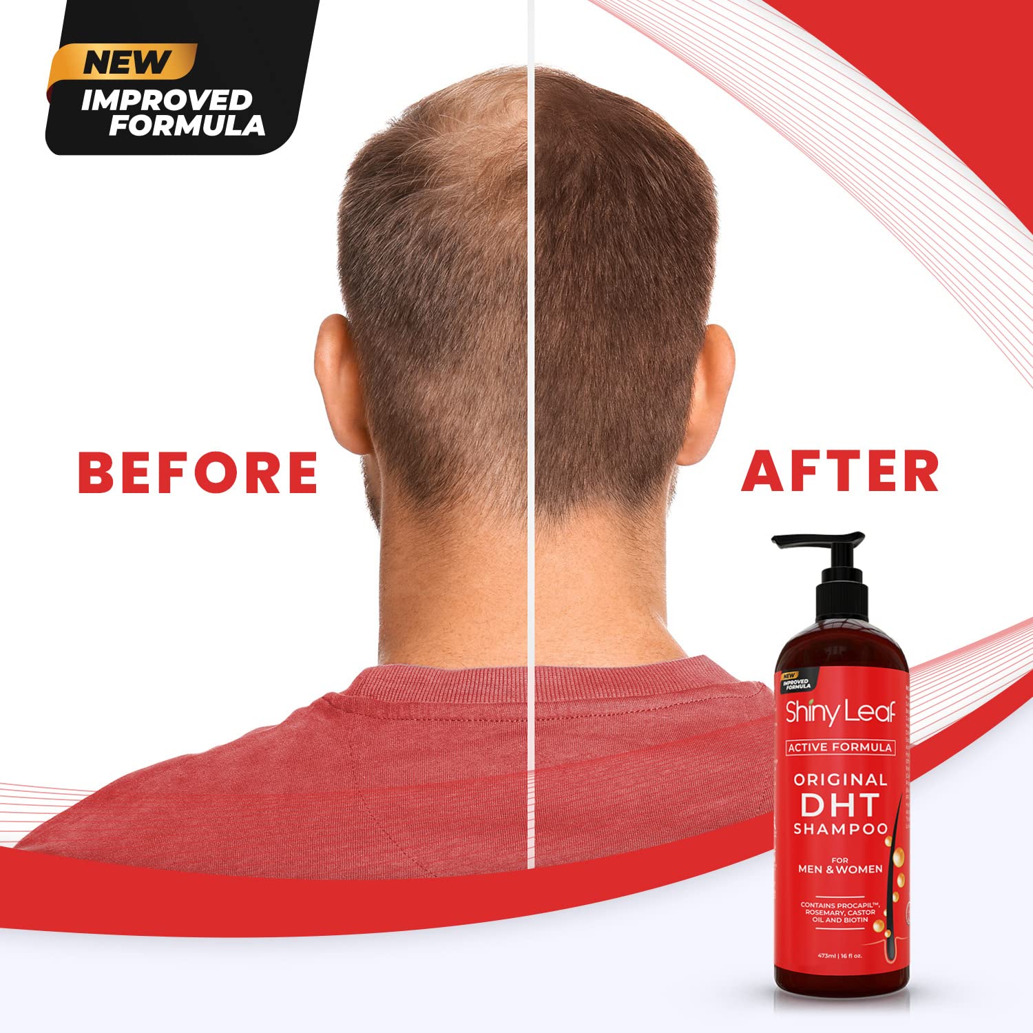 DHT Blocker Hair Loss Shampoo with Biotin — 16 oz by Shiny Leaf