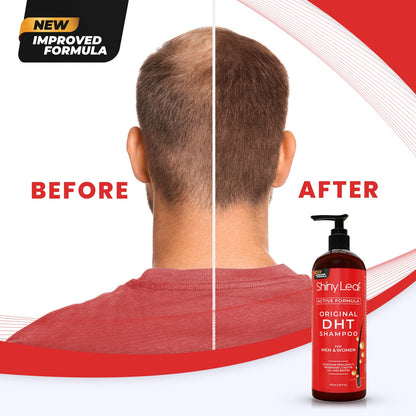 DHT Blocker Hair Loss Shampoo with Biotin — 16 oz by Shiny Leaf