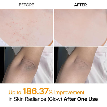 Dr. Melaxin Peel Shot Exfoliating Kojic Acid Turmeric Spray by AsiaBeautyMall
