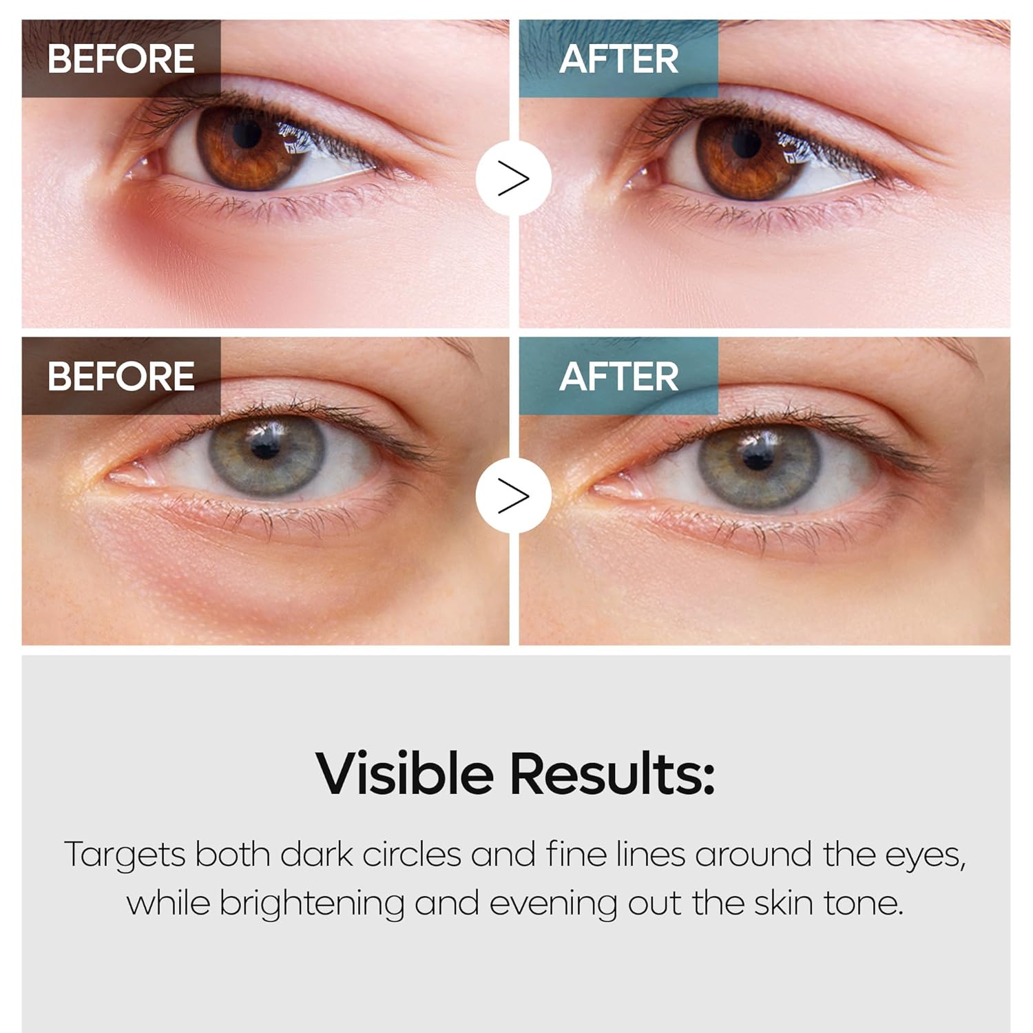 Dr. Melaxin TX Retinalsome Double Effect Eye Cream by AsiaBeautyMall