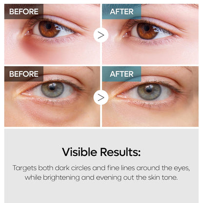 Dr. Melaxin TX Retinalsome Double Effect Eye Cream by AsiaBeautyMall